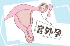 試管移植后會不會宮外孕？做試管時如何防止？