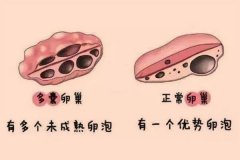 多囊能不能促排 多囊卵巢促排卵懷孕率高嗎