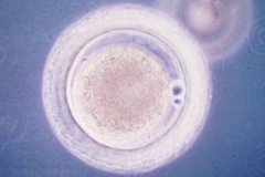 試管嬰兒移植囊胚需要注意什么?囊胚是直接著床嗎?