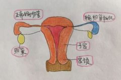 輸卵管積水做B超能看得出來嗎？影響做試管嗎？