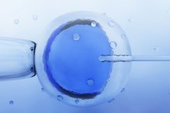 多囊卵巢可以做試管嬰兒嗎？多囊試管成功率高嗎？