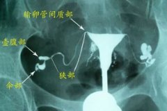 做輸卵管檢查對身體有傷害嗎？檢查輸卵管要多久？