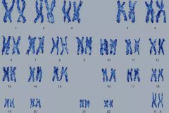 胎兒畸形篩查怎么做？懷孕能不能查染色體？