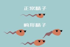 胎兒畸形與精子畸形有關嗎？精子畸形的危害有哪些呢？