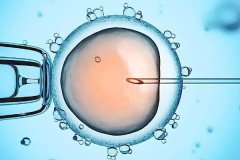 人工授精、試管嬰兒和自然受孕的區別？