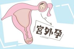 移植囊胚會宮外孕的嗎？囊胚移植宮外孕的癥狀有哪些？